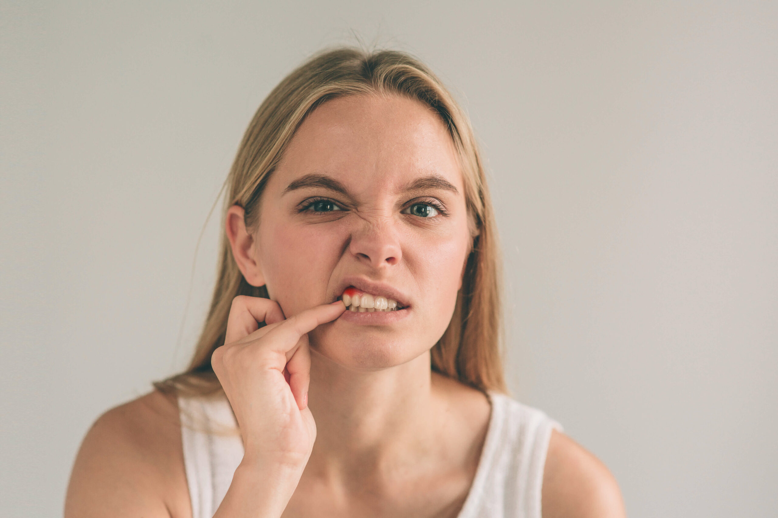 Featured image for “Oral Thrush: What Is It?”