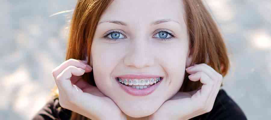 Featured image for “Braces Alternatives for Teens That are Actually Cool”