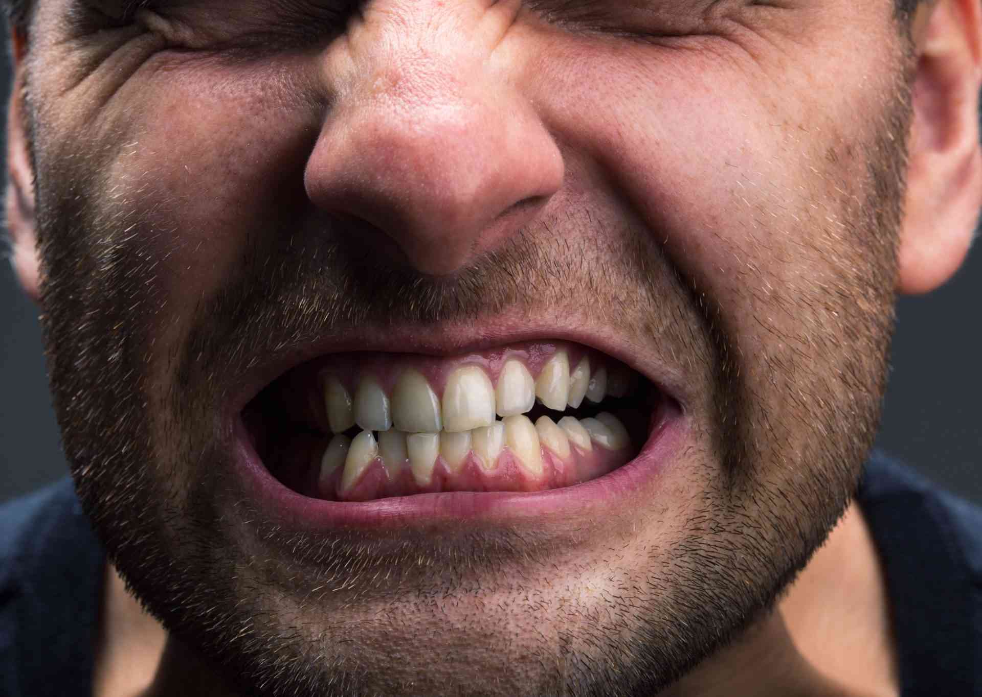 Featured image for “Why You Can’t Stop Teeth Grinding”
