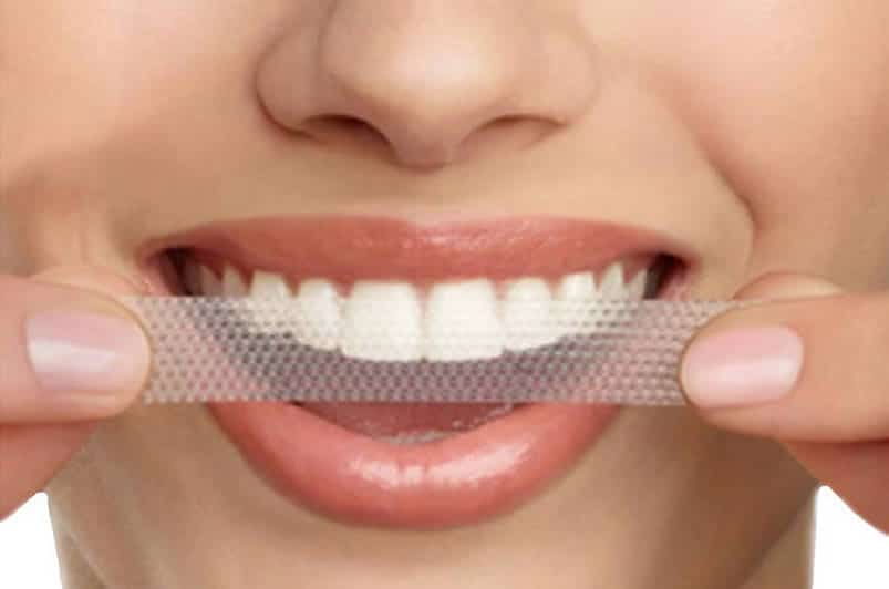Featured image for “Professional Teeth Whitening Treatments vs. Whitening Strips”
